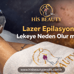 Lazer Epilasyon Lekeye Neden Olur mu?