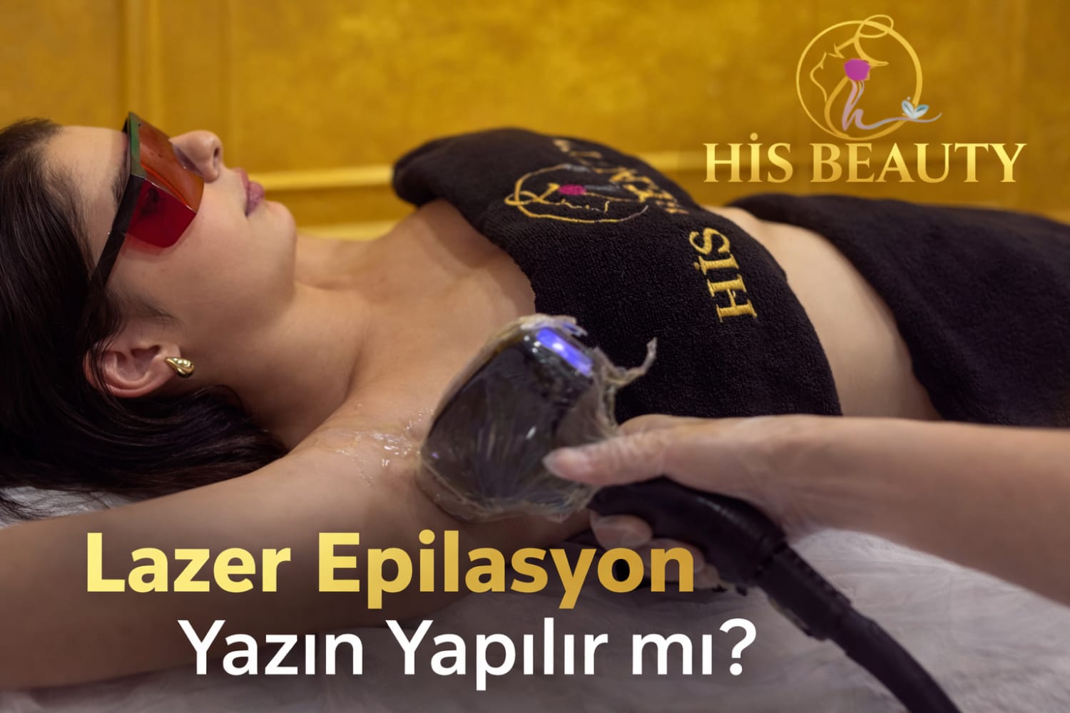 Yaz aylarında lazer epilasyon uygulaması yapılan kadın danışan