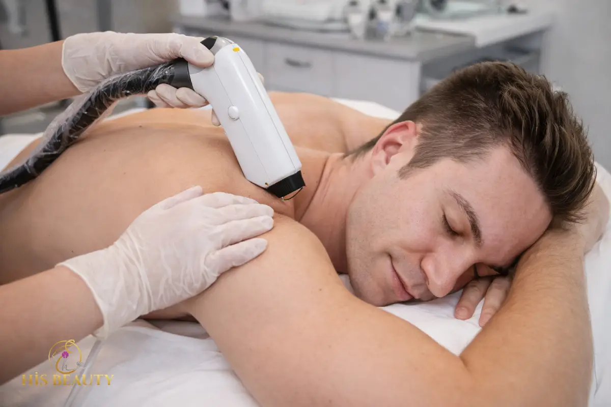 Kaynarca erkek lazer epilasyon hizmeti Pendik Kaynarca erkeklere özel kalıcı lazer epilasyon uygulaması