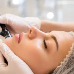 Hydrafacial Sonrası Nelere Dikkat Edilmeli?