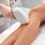İnce Tüylerde Hangi Lazer Kullanılır?